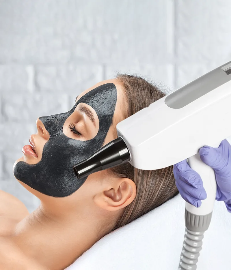 Black Peel Treatment