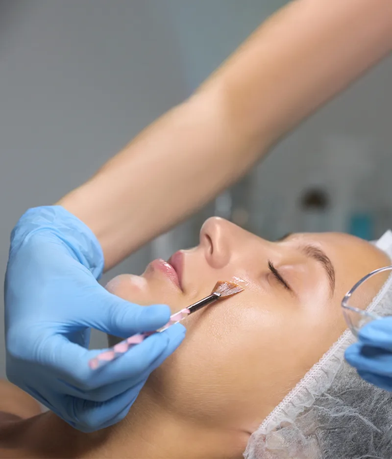 Meline Peeling Treatment