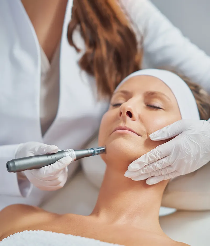 Mesotherapy Treatment