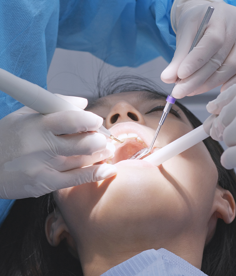 Root Canal Treatment